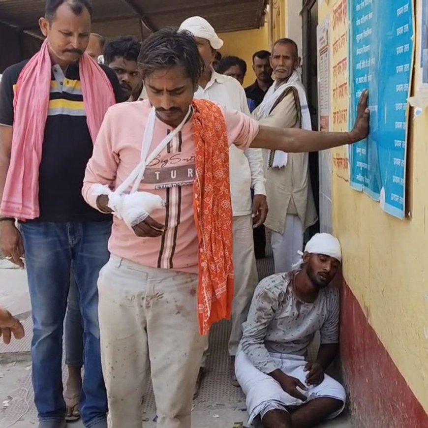 चंदौली में ट्रैक्टर-ऑटो को पास कराने में भिड़े दो पक्ष:लाठी-डंडों से हमला, चार लोग घायल, आरोपी फरार