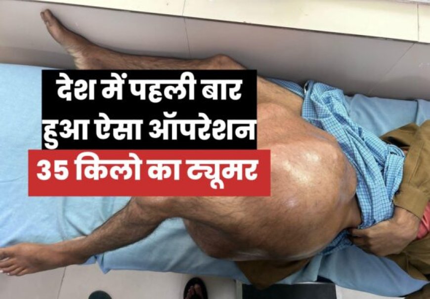 उत्तराखंड : अजब-गजब! डॉक्टरों ने निकाला 35 किलो का बोन ट्यूमर, देश में अब तक का सबसे बड़ा! VIDEO
