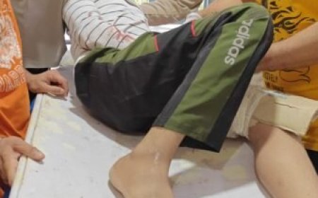 उत्तरकाशी में नालूपानी के पास बाइक दुर्घटनाग्रस्त, तीन युवक हुए घायल