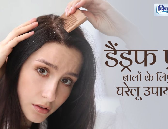 Dandruff In Winter : सर्दियों में बढ़ गई है डैंड्रफ की समस्या, तो इन नुस्खों से पा सकते हैं साफ स्कैल्प