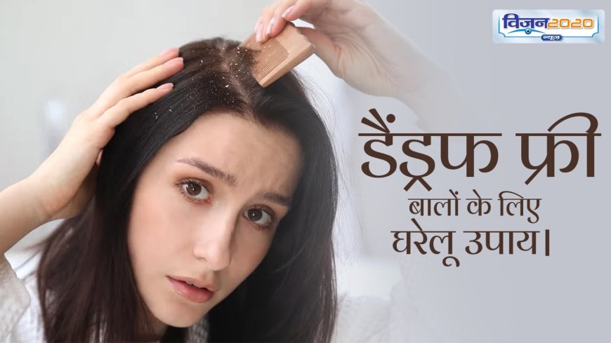 Dandruff In Winter : सर्दियों में बढ़ गई है डैंड्रफ की समस्या, तो इन नुस्खों से पा सकते हैं साफ स्कैल्प
