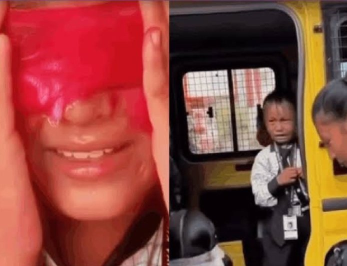मोबाइल की लत छुड़ाने के लिए बच्चों को डराने का वीडियो वायरल, डॉक्टर ने निकाल दीं दोनों आंखें