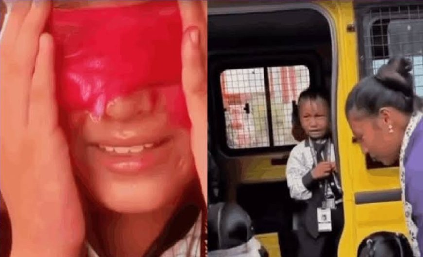 मोबाइल की लत छुड़ाने के लिए बच्चों को डराने का वीडियो वायरल, डॉक्टर ने निकाल दीं दोनों आंखें